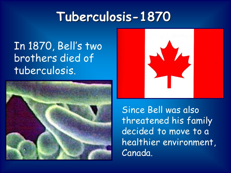 Tuberculosis-1870     In 1870, Bell’s two brothers died of tuberculosis. 